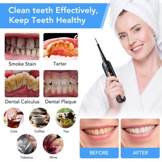 Xiaomi youpin dụng cụ lấy cao răng - máy lấy cao răng tại nhà dễ dang sử dụng bộ dụng cụ làm sạch răng màn hình led
