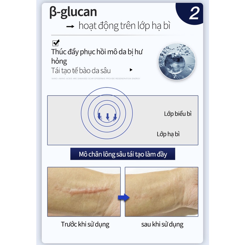 Kem Sẹo Kem xóa Sẹo Thâm Kem sẹo 50g Xóa sẹo thâm rạn da hiệu quả mờ thâm bỏng thương phẫu thuật
