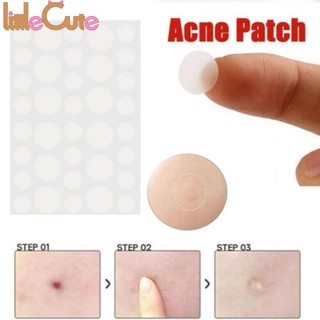 Bộ 36 miếng dán mụn hydrocolloid vô hình chăm sóc da hiệu quả