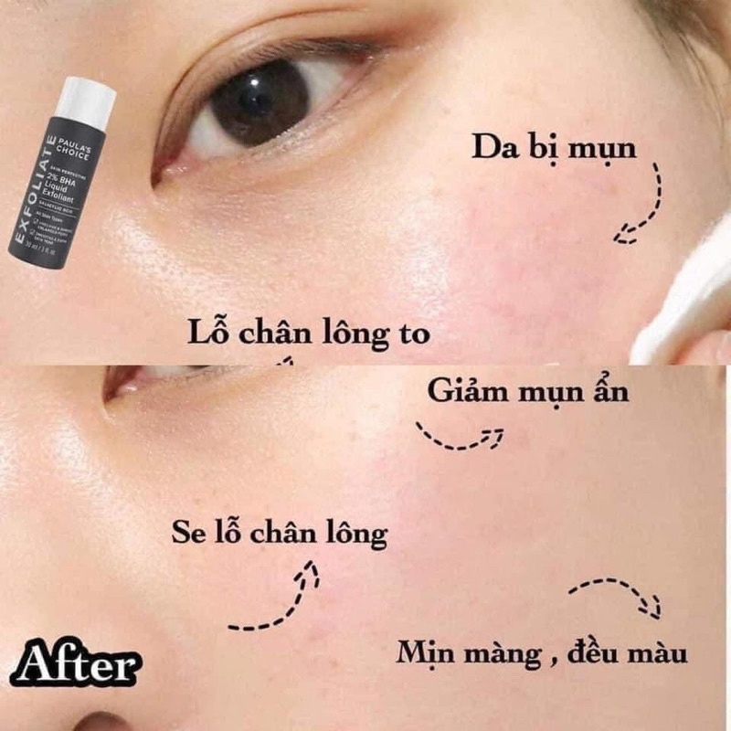 Dung dịch loại bỏ tế bào chết Paulas Choice Skin Perfecting 2% BHA Liquid Exfoliant 118 ml