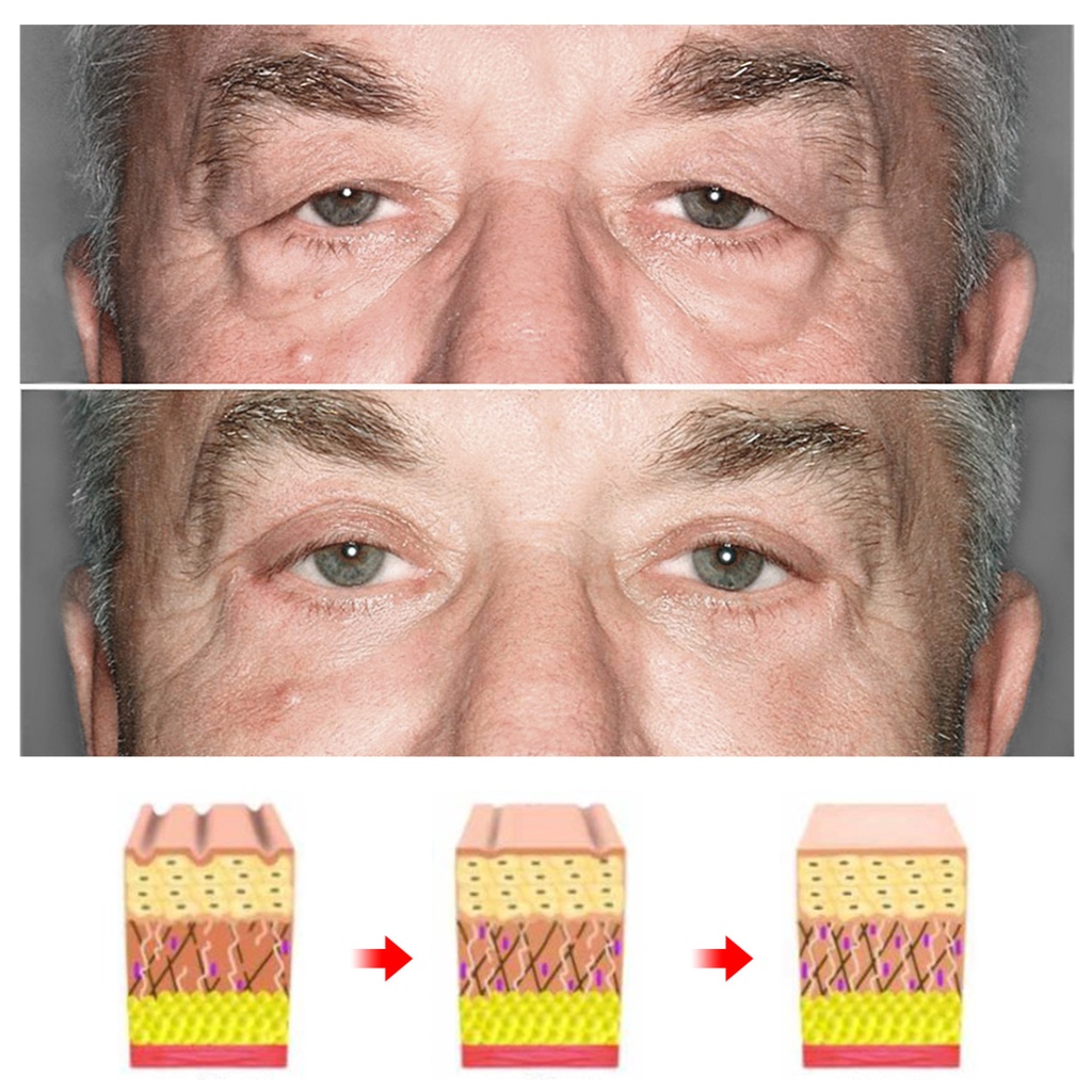 Kem Dưỡng Da Mắt Chống Lão Hóa Xóa Mờ Quầng Thâm / Bọng Mắt Làm Săn Chắc Da Cho Nam