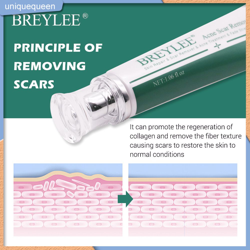 Kem Sửa Chữa Sẹo Breylee 30G Loại Bỏ Vết Rạn Da Trị Nám Chống Dị Ứng Bình Tĩnh Làm Trắng Da Trị Sẹo Uni