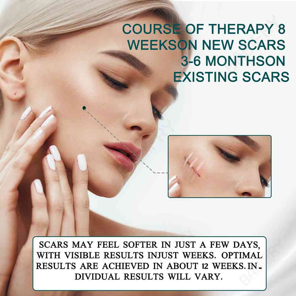 Cuộn Băng Keo Silicone 3M Loại Bỏ Sẹo Hiệu Quả