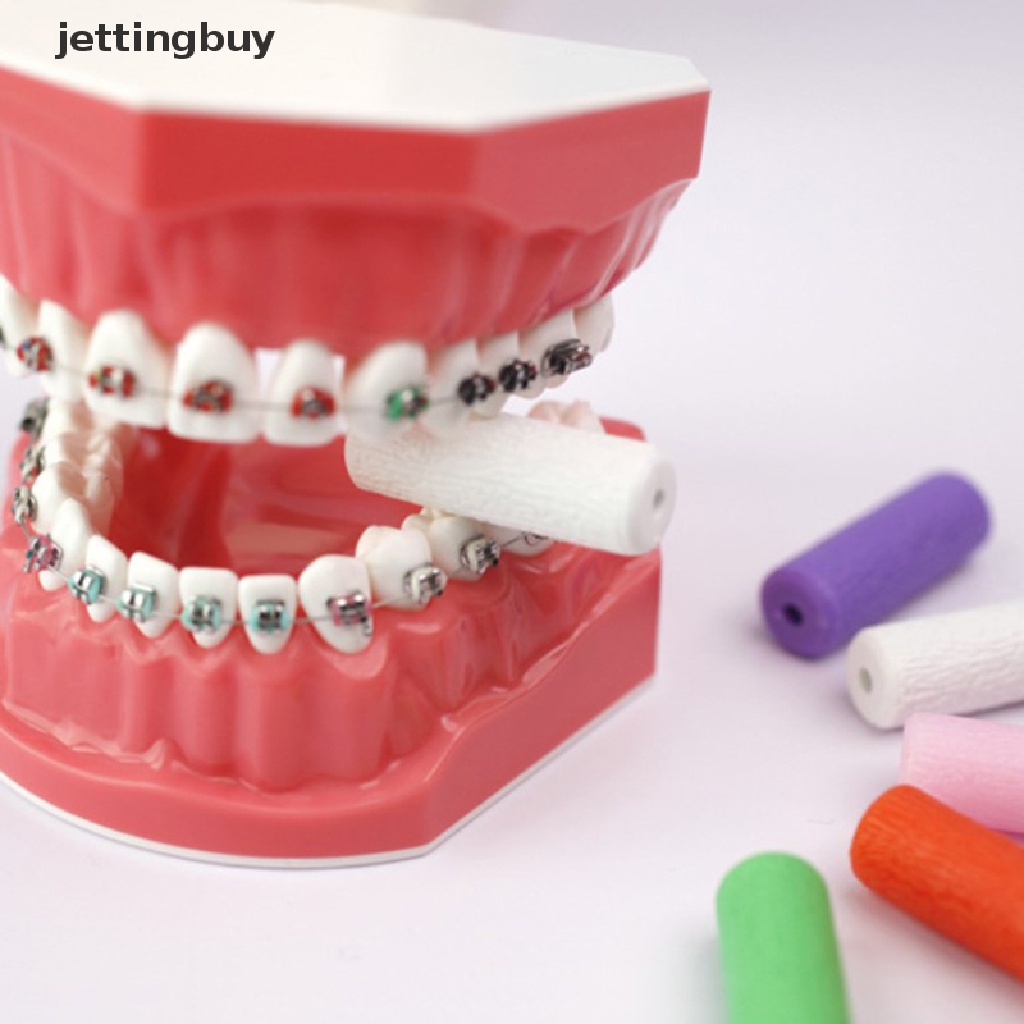 Bộ 2 Dụng Cụ Niềng Răng Cho Nha Khoa