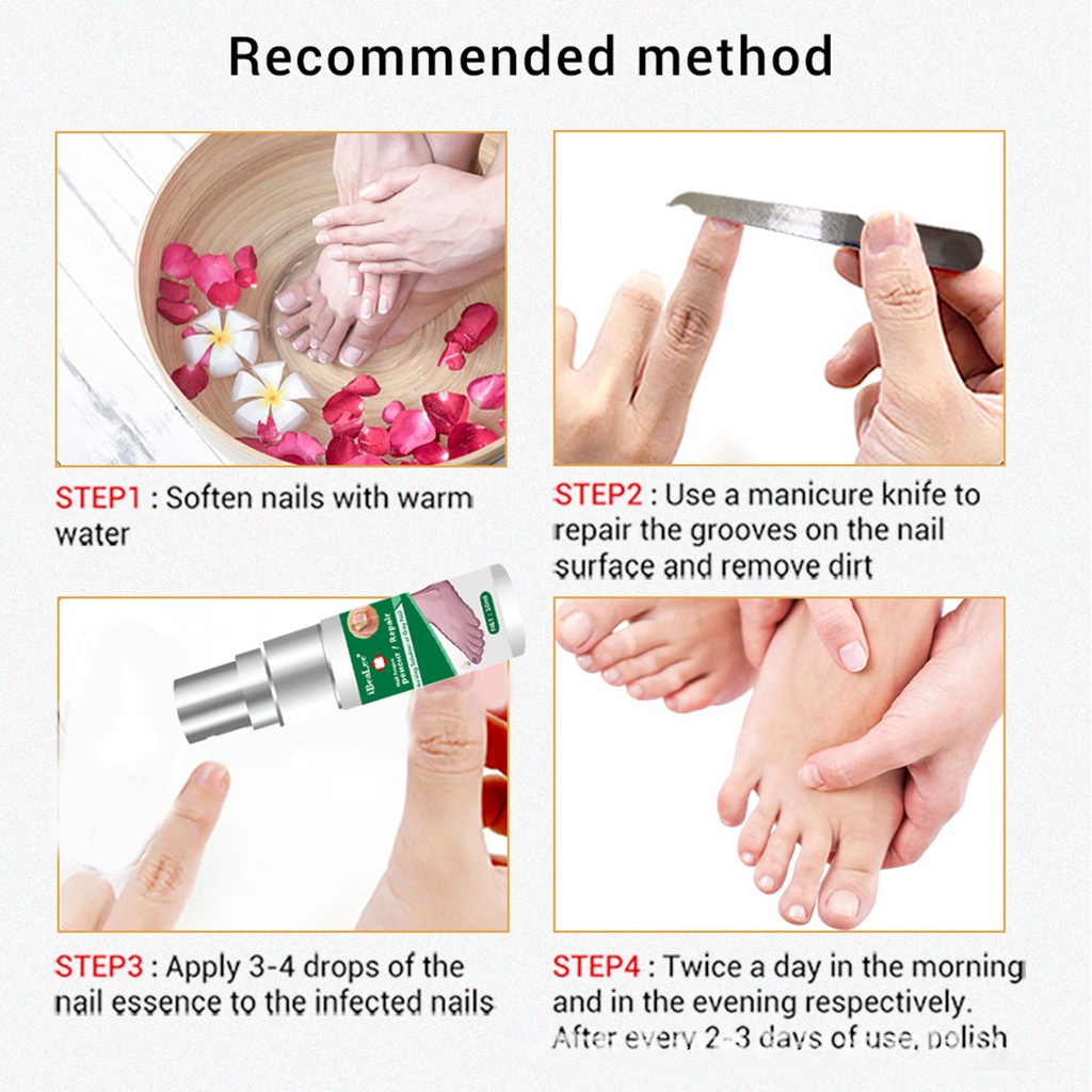 Dung Dịch Dưỡng Móng Kháng Khuẩn 10ml Dễ Sử Dụng