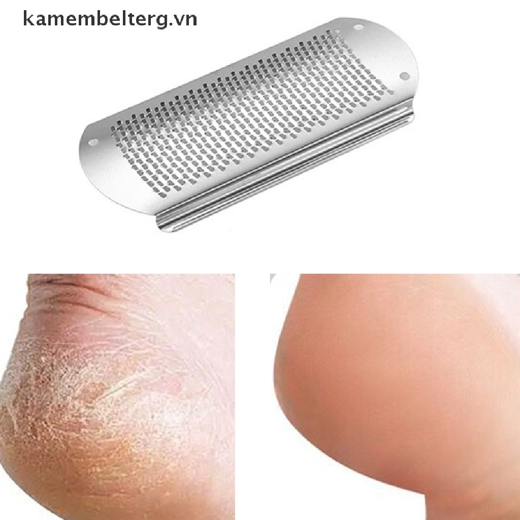 Dụng Cụ Chà Gót Chân Tẩy Tế Bào Chết Bằng Thép Không Gỉ