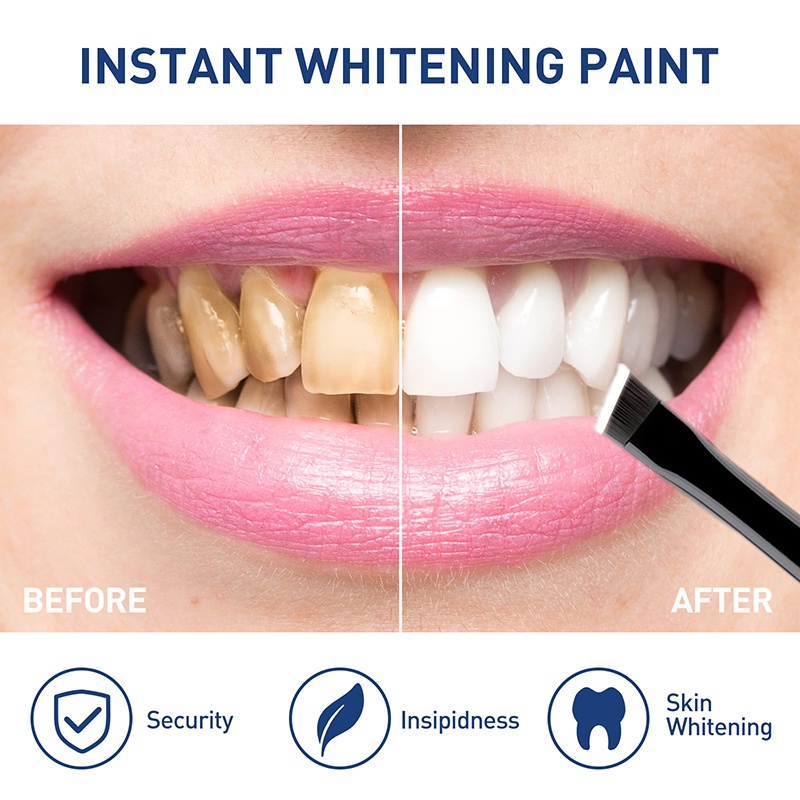 Sơn Làm Trắng Răng An Toàn Dễ Sử Dụng 5ml JP5VN