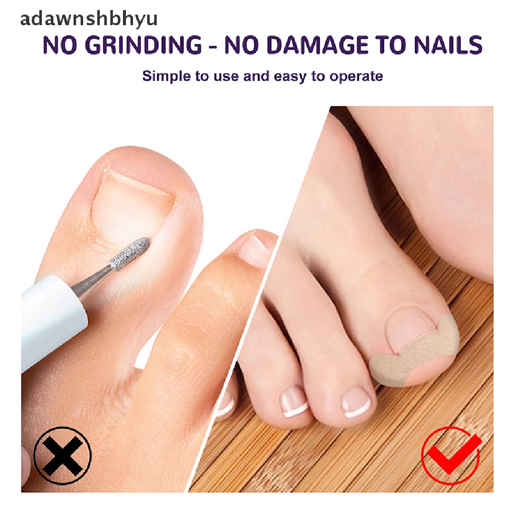 Set 50 Miếng Dán Chỉnh Sửa Móng Chân Mọc Ngược Tiện Dụng