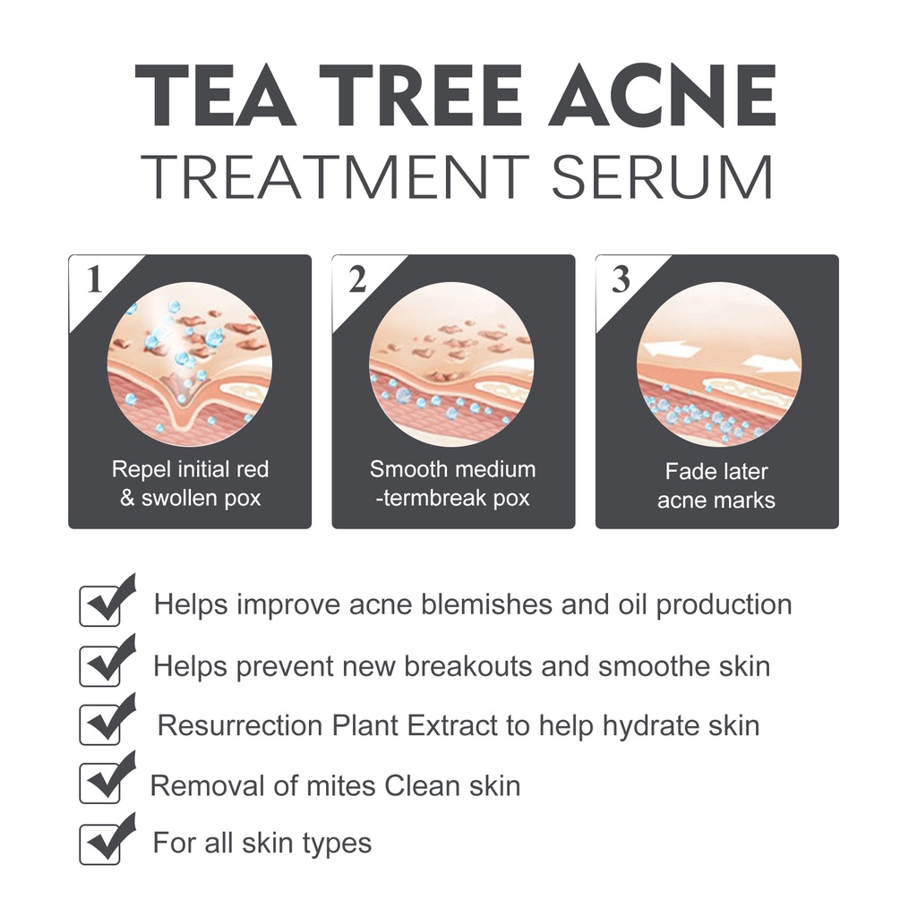 Serum Axit Salicylic 2% Tẩy Tế Bào Chết Hỗ trợ giảm mụn OUHOE