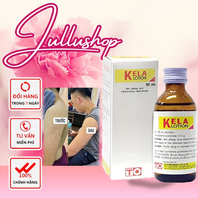 Kela Lotion Thái Lan Dành Cho Da Viêm Viêm Lỗ Chân Lông 30ml/60ml