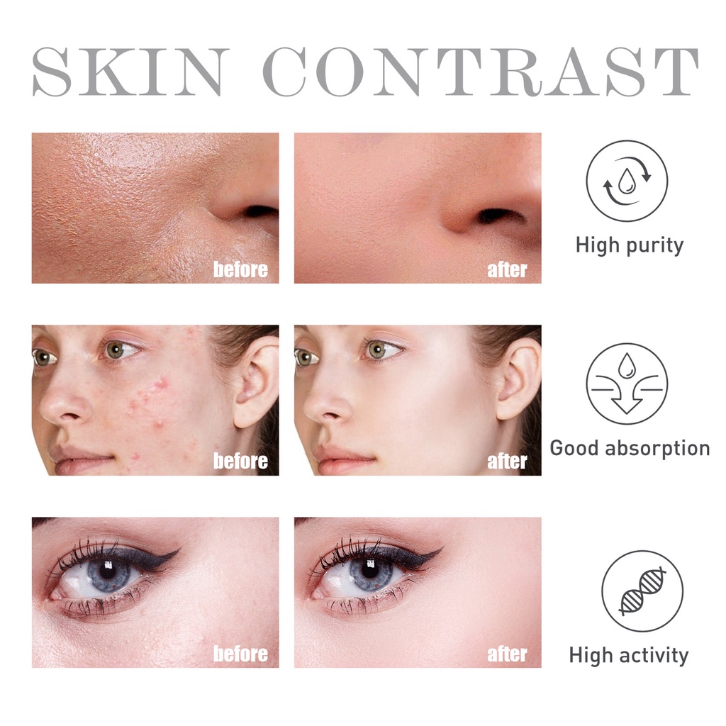 Serum Axit Salicylic 2% Tẩy Tế Bào Chết Hỗ trợ giảm mụn OUHOE