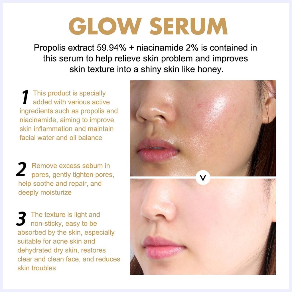 Tinh Chất Niacinamide 30ml Giúp Làm Sáng Và Xóa Vết Thâm Cho Da Mặt