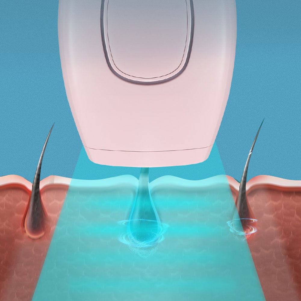 Máy Triệt Lông IPL Vĩnh Viễn Laser Không Đau Cho Nam Nữ