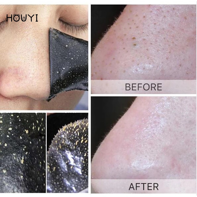 Mặt Nạ Lột Mụn Đầu Đen Kiểm Soát Dầu Thu Nhỏ Lỗ Chân Lông 20g
