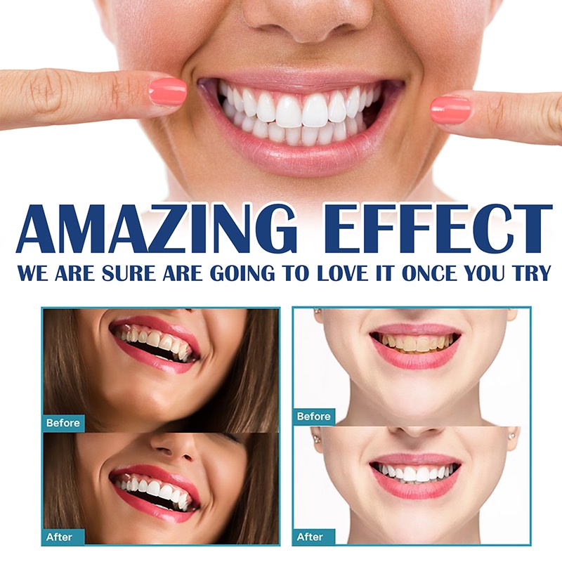 Sơn Làm Trắng Răng An Toàn Dễ Sử Dụng 5ml JP5VN