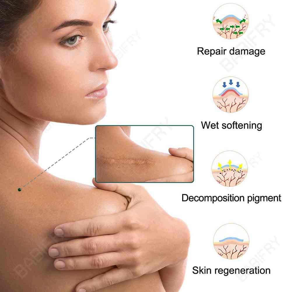 Cuộn Băng Keo Silicone 3M Loại Bỏ Sẹo Hiệu Quả