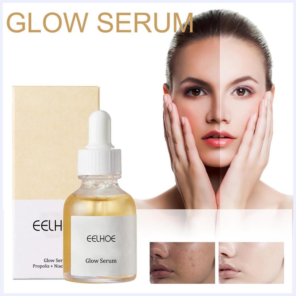 Tinh Chất Niacinamide 30ml Giúp Làm Sáng Và Xóa Vết Thâm Cho Da Mặt