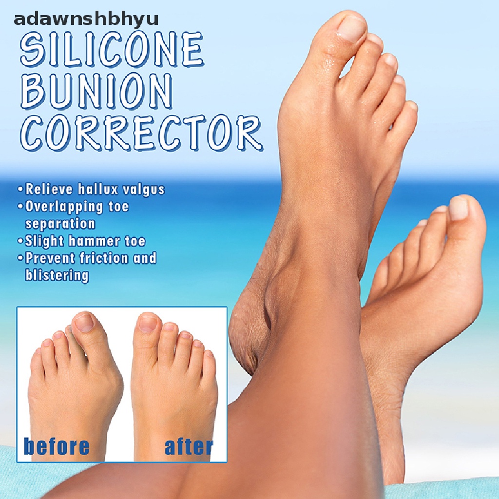 1 Cặp Silicon Tách Ngón Chân Cái Bảo Vệ Hiệu Quả
