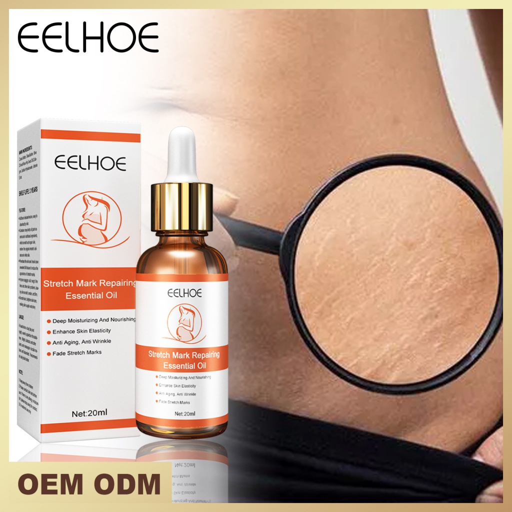Spot# eelhoe stretch repair desalinized essential oil pregnant women pull tight loose pregnancy remove pregnancy skin care essence 3.13NA