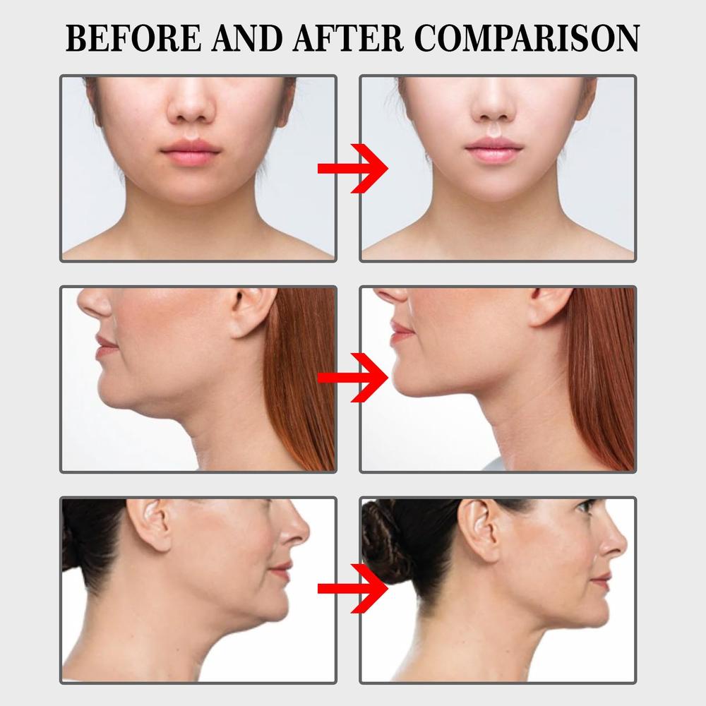 V-Shape Facial Lifting Patch Material Safety Invisible Face Stickers Fade Fine Lines Lift Tighten Jaw Tape Anti Wrinkle