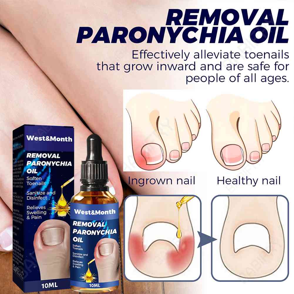 Dung Dịch Hỗ Trợ Giảm Bệnh Nấm Móng Đa Năng 10ml