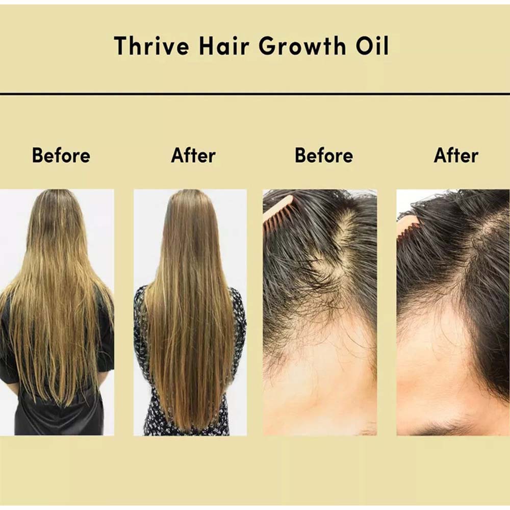 Thirive Hair Oil Essential Oil For Hair Growth Natural Nourishes Hair