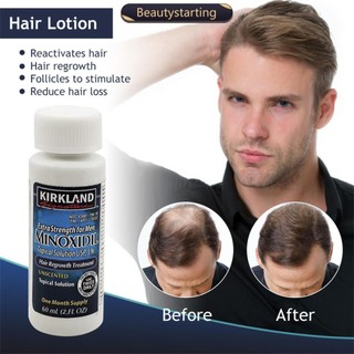 Tinh Chất Kirkland Minoxidil Kích Thích Mọc Râu Hiệu Quả A6V9