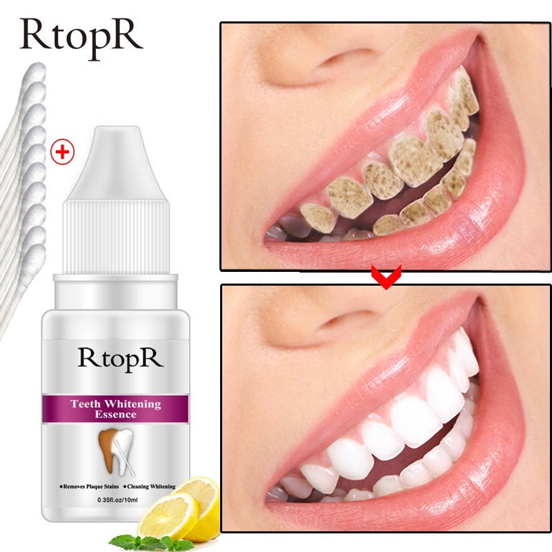 Tinh chất làm trắng răng RtopR Làm sạch sâu hiệu quả Làm mới răng Làm mới vết ố trên răng Loại bỏ mảng bám để vệ sinh răng miệng Chăm sóc răng miệng
