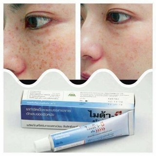 Kem nám đồi mồi Myda-B Thái Lan