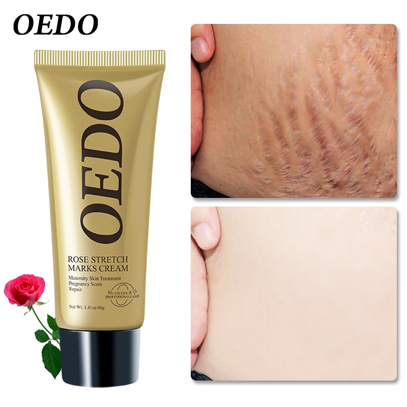 Kem Hỗ trợ giảm rạn da Chống Lão Hóa Và Nếp Nhăn Cho Phụ Nữ Mang Thai