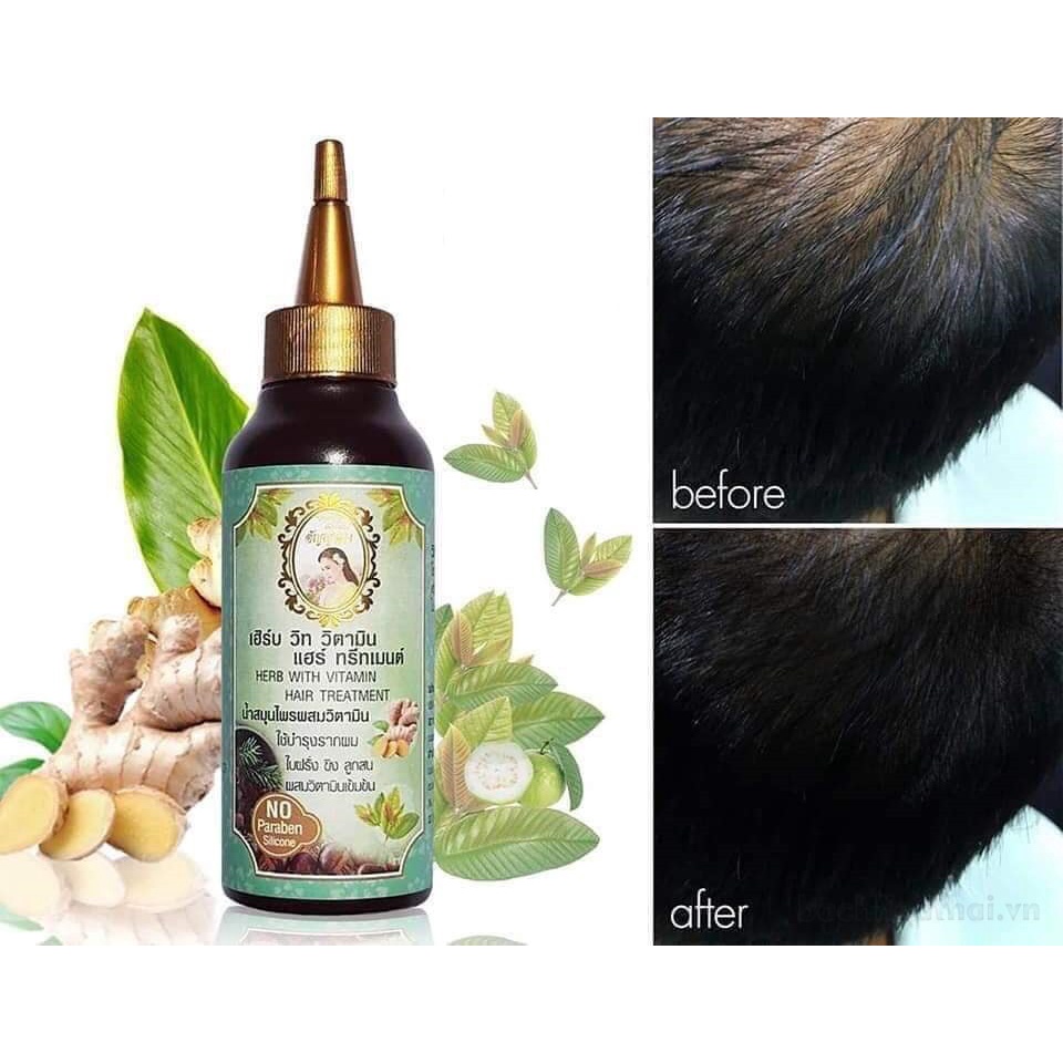 Kích mọc tóc Anyanang Herb With Vitamin Hair Treatment Thái Lan