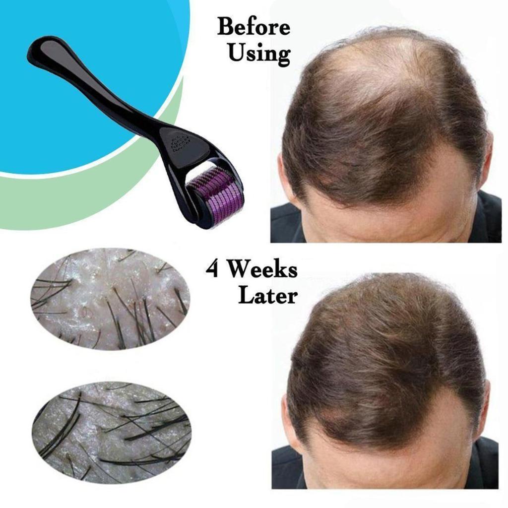 Titanium Beard Growth & Hair Regrowth Anti Hair Loss Hair Skin Roller