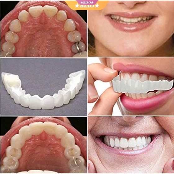 Hàm Răng Giả Chuyên Dụng Cho Nha Khoa