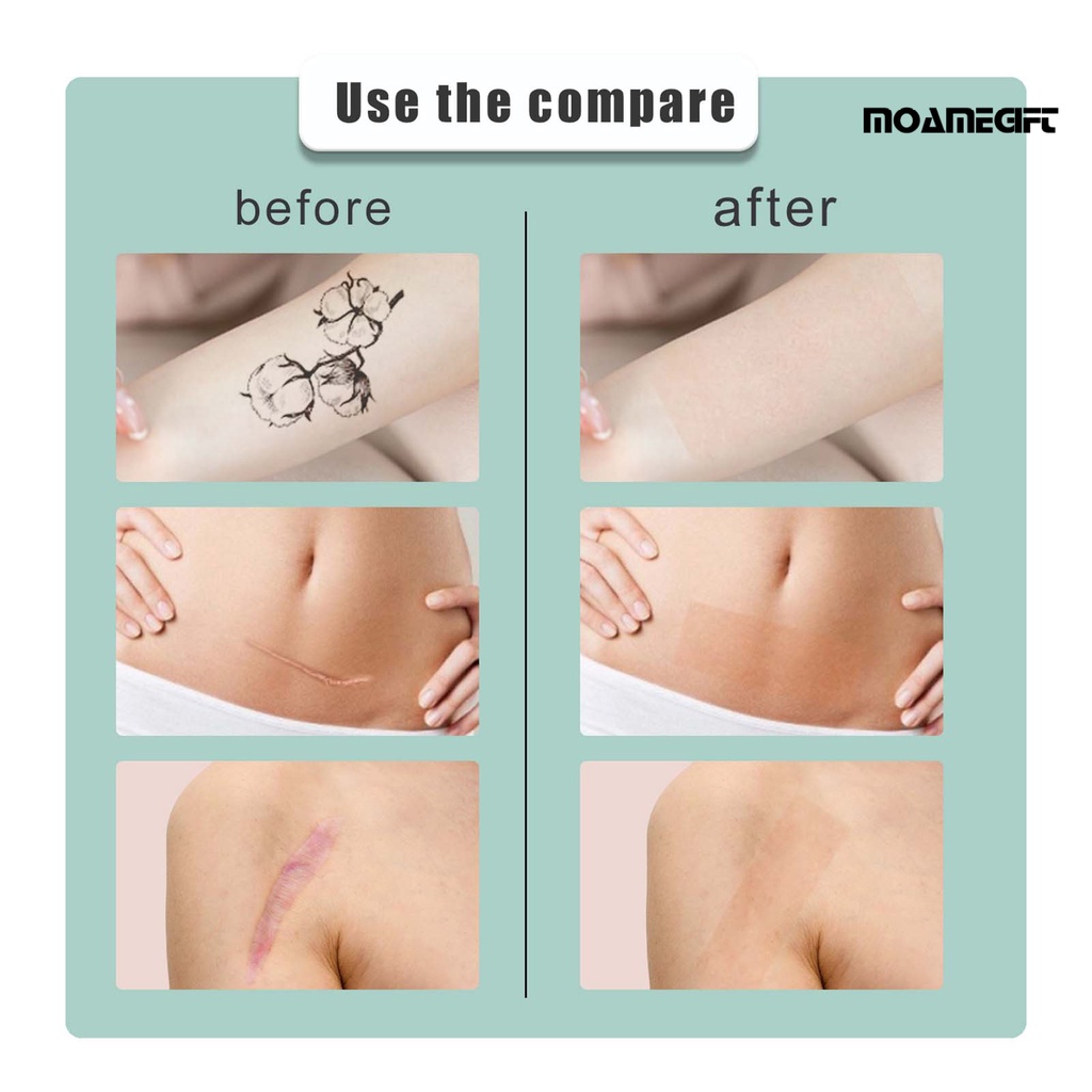 Hộp 50g Miếng Dán Che Khuyết Điểm Hình Xăm Nhẹ Nhàng Không Gây Đau Chống Thấm Nước