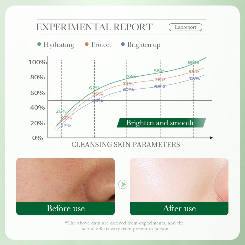 Sữa Rửa Mặt Bioaqua 100g Làm Sạch Sâu Lỗ Chân Lông Chăm Sóc Da