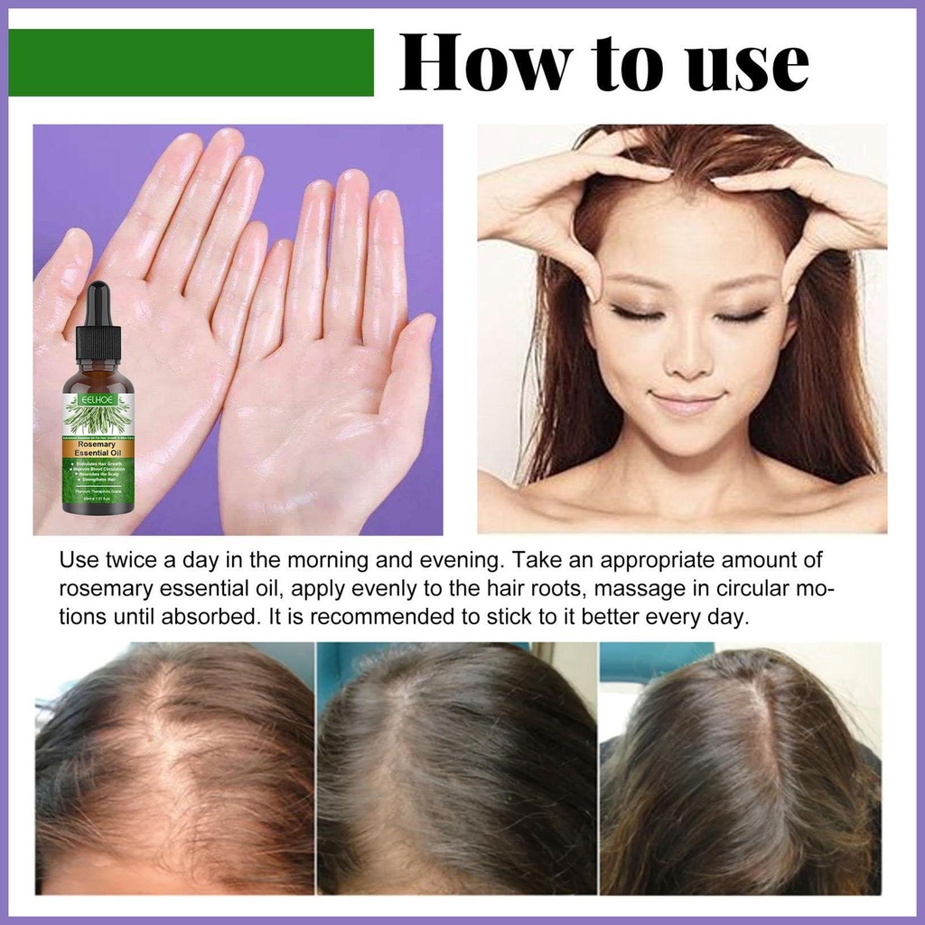 Tinh Chất Kích Thích Mọc Tóc 30ml Nuôi Dưỡng Da Đầu Và Tóc nota2vn