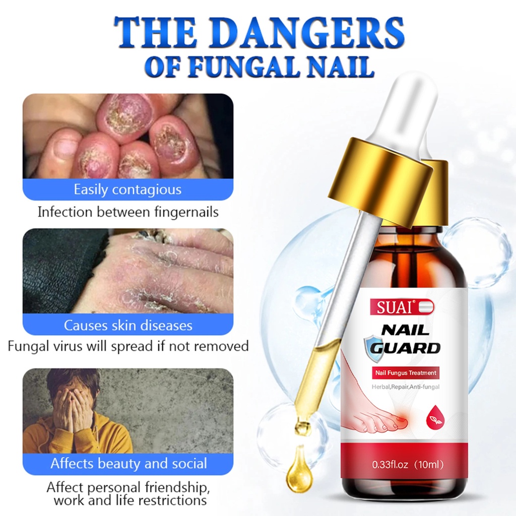 10ml Móng Tay Điều Hỗ trợ giảm nấm Serum Chống Nhiễm Trùng Paronychia Onychomycosis Loại Bỏ Ngón Chân Nấm Bàn Tay Sửa Chữa Gel Chăm Sóc Serum