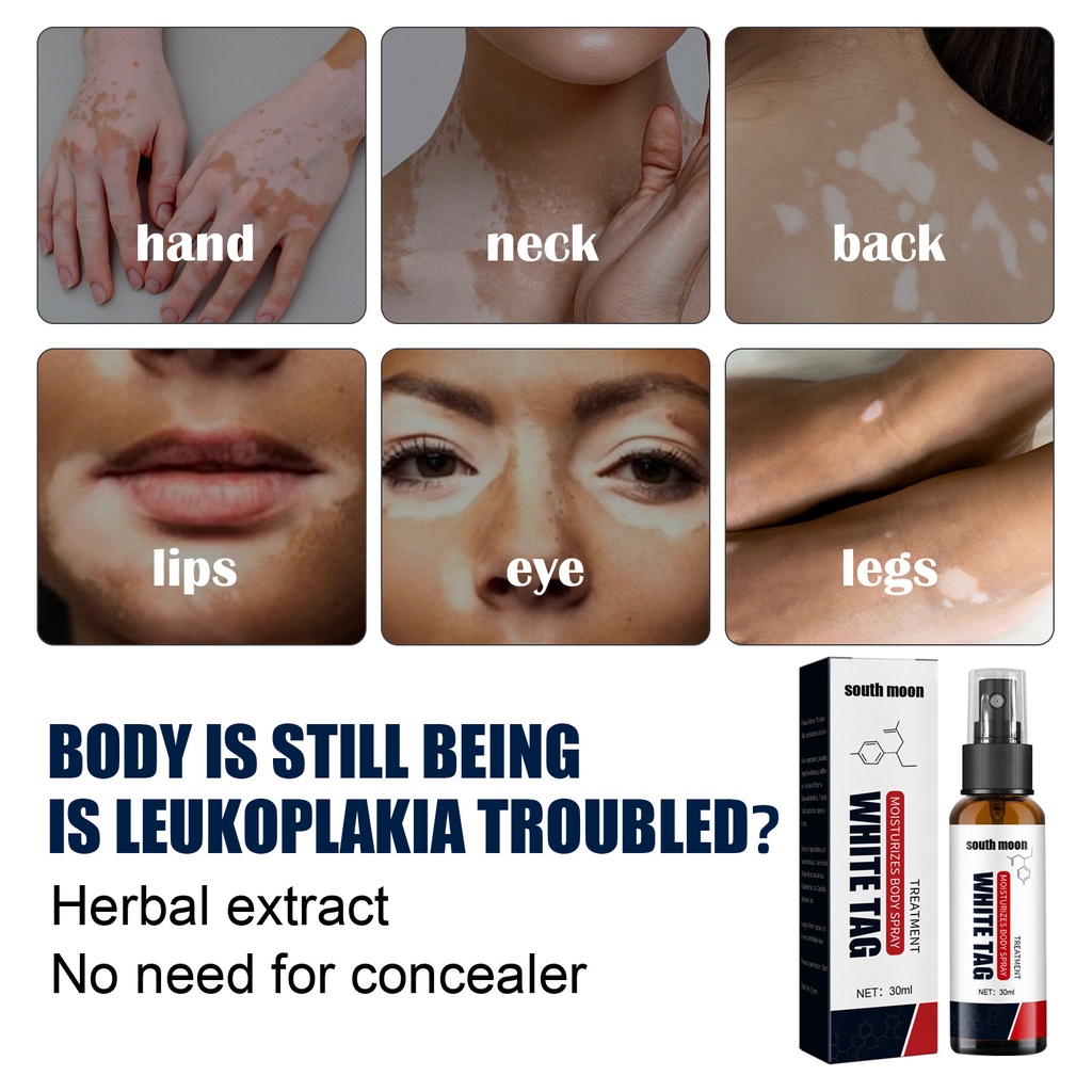 Tik Tok Bán Chạy#South Chai Xịt Tẩy Trang Làm Sạch Xương Đốm Trắng Da Ngoài Trời 6.30 cjL