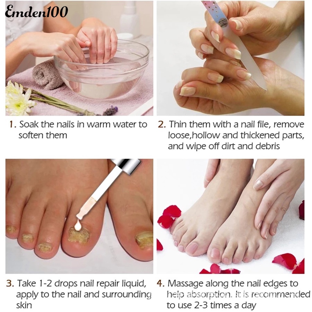 Dung Dịch Kháng Khuẩn 10ml Dễ Sử Dụng Cho Chăm Sóc Móng Tại Nhà