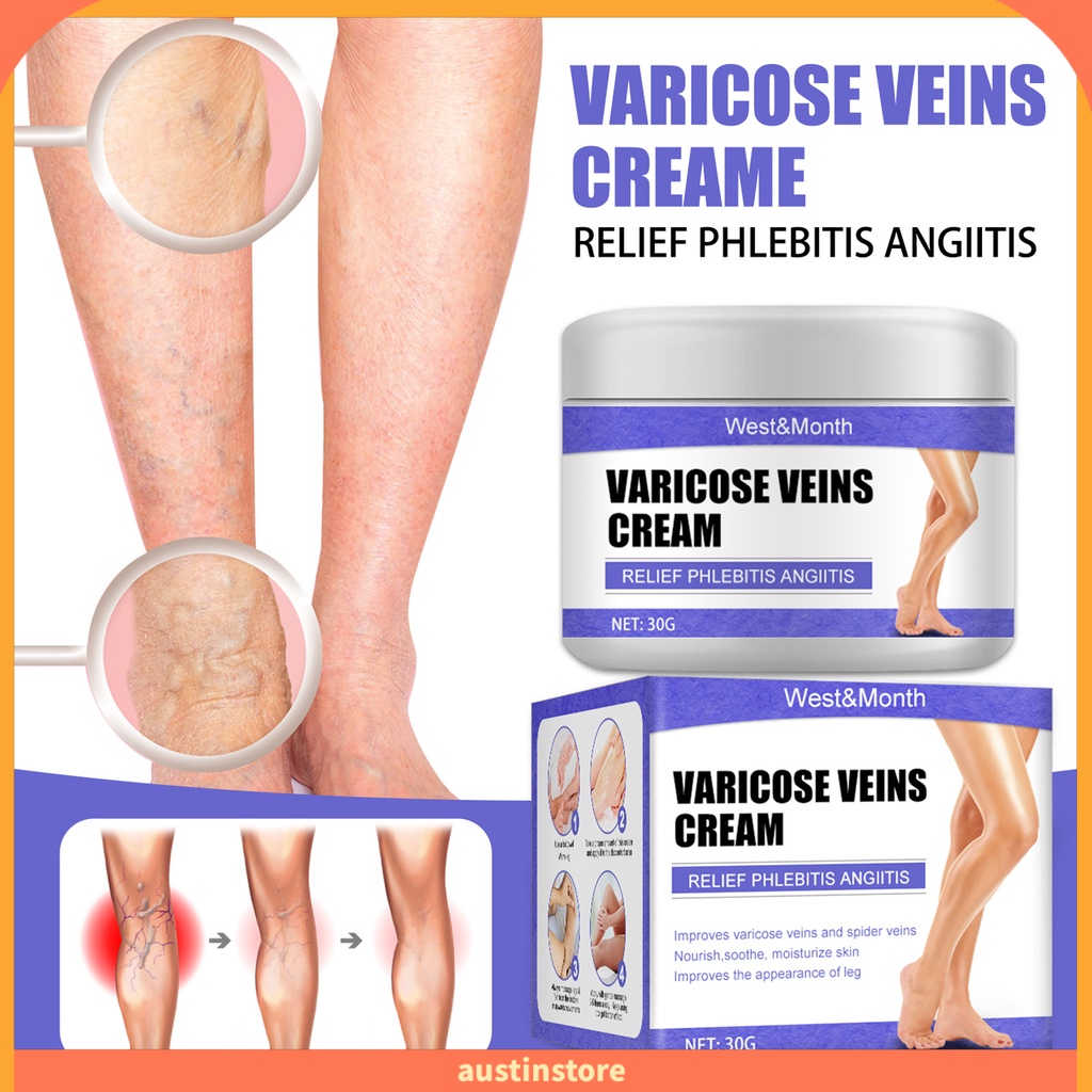 Kem Trị Giãn Tĩnh Mạch Chiết Xuất Thực Vật 30g