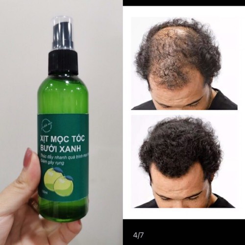 PVN59057 Tinh dầu Bưởi Xanh 100ml ngăn rụng tóc và kích thích mọc tóc