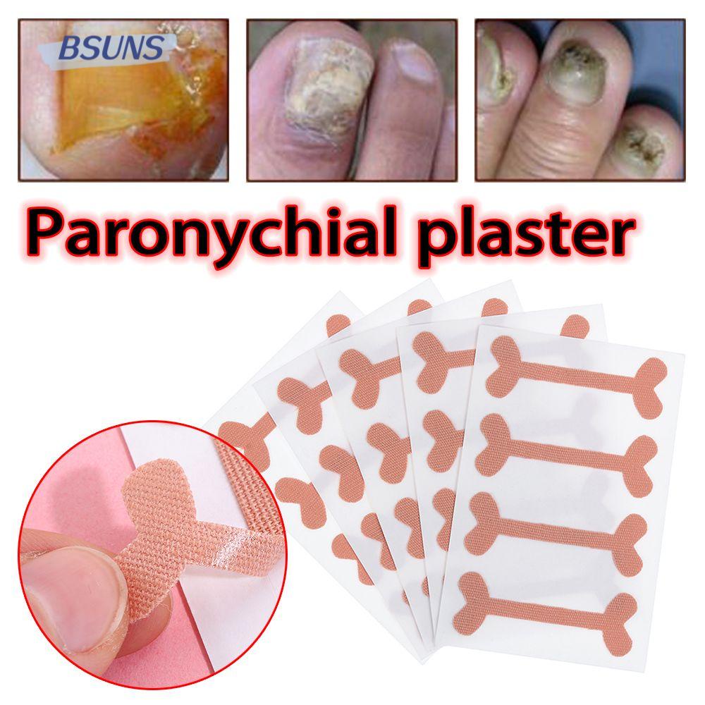 Miếng Dán Chỉnh Hình Móng Chân Chuyên Nghiệp Tiện Dụng