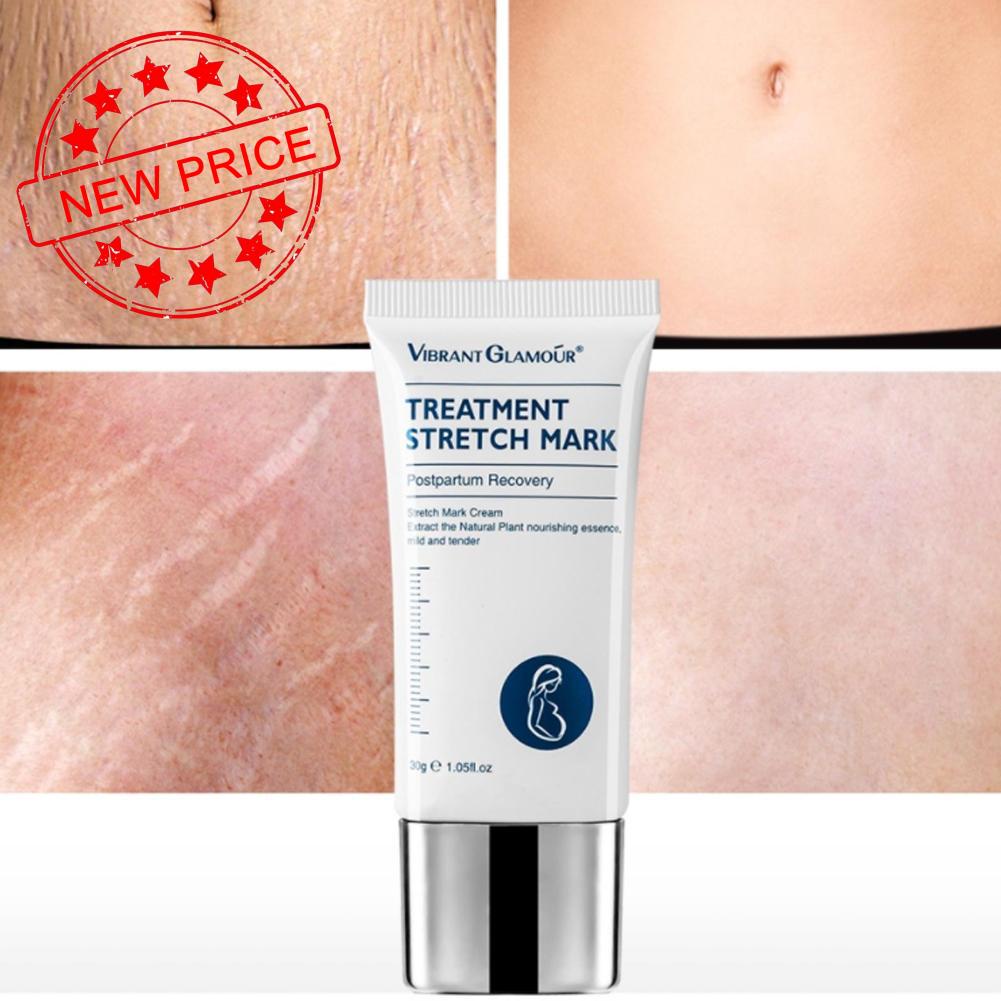 Kem 30g VIBRANT GLAMOUR N9W9 Giúp Giảm Nếp Nhăn Và Cải Thiện Làn Da Sau Sinh