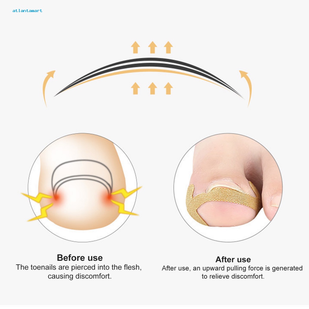 Túi Đựng Đồ Dùng Cao Cấp Tiện Dụng| 1 Bộ Miếng Dán Chỉnh Hình Móng Chân Thoáng Khí