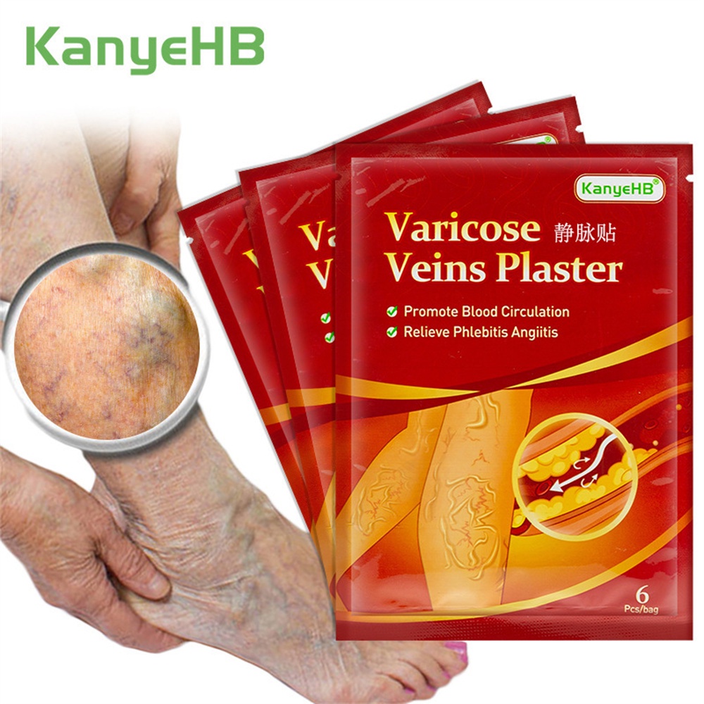 KanyeHB Miếng Dán Giãn Tĩnh Mạch Giảm Sự Khó Chịu Và Cải Thiện Lưu Thông 6 Miếng Mỗi Túi Miếng Dán Tĩnh Mạch Màu đen Miếng Dán Tĩnh Mạch 6 Miếng KKDURANT