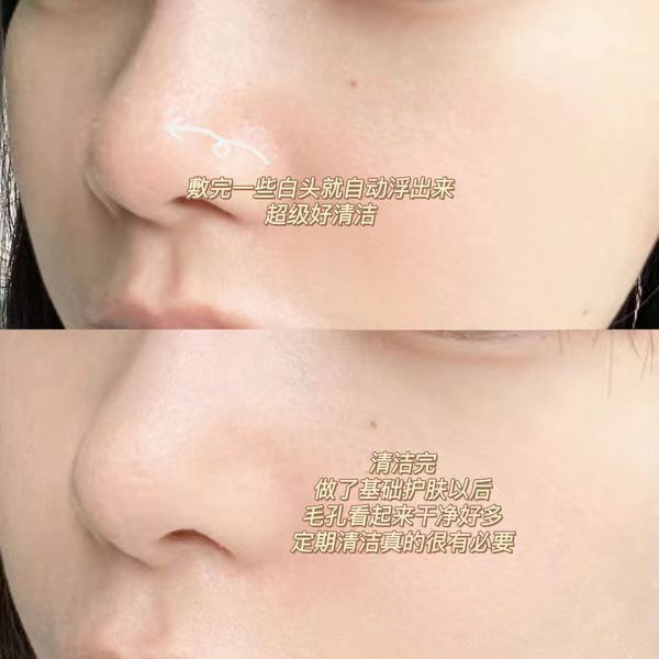 Mặt Nạ Bùn Làm Sạch Sâu Lỗ Chân Lông Loại Bỏ Mụn Đầu Đen 100G hapsode