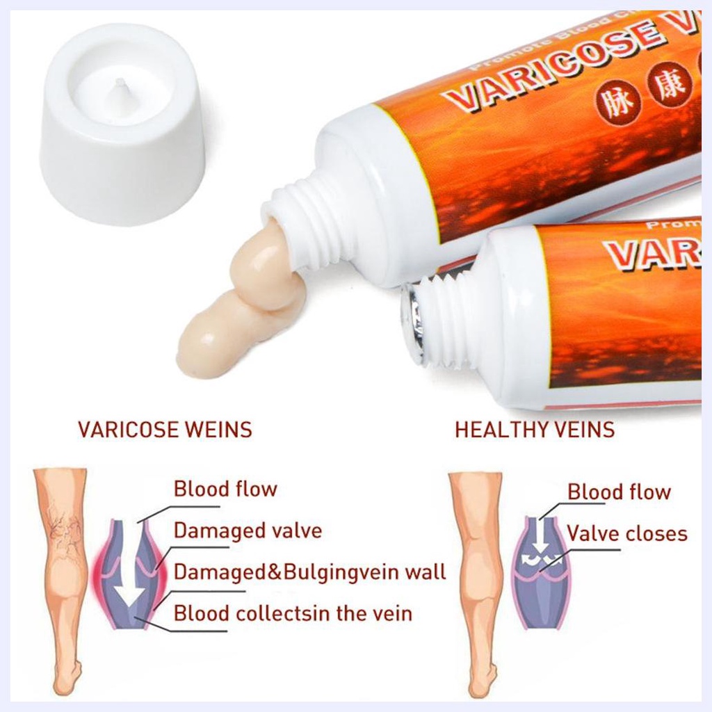 Kem trị suy giãn tĩnh mạch Maikang Cream Leg Care 20g