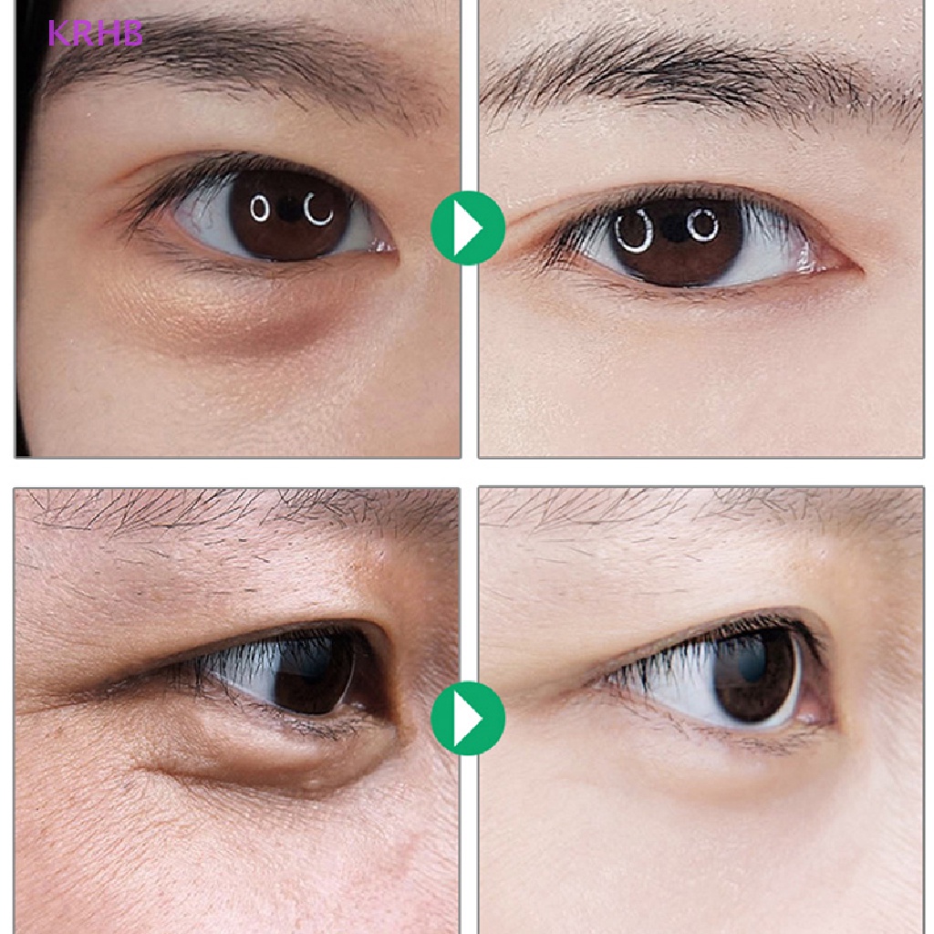 1 Cặp Miếng Dán Silicone Loại Bỏ Nếp Nhăn Vùng Mắt Có Thể Tái Sử Dụng