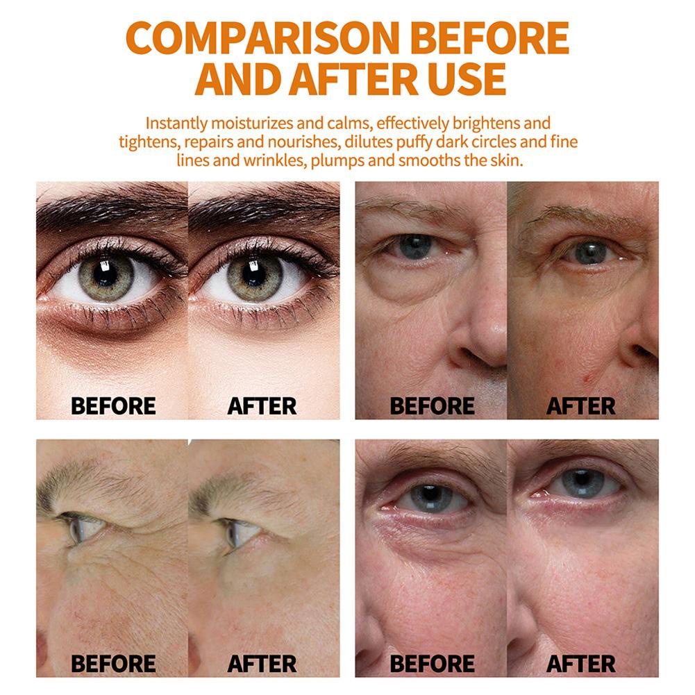 Tinh Dầu Dưỡng Da Mắt Q0I1 Dạng Lăn Hydrat Hóa Dưỡng Ẩm Cho Nam