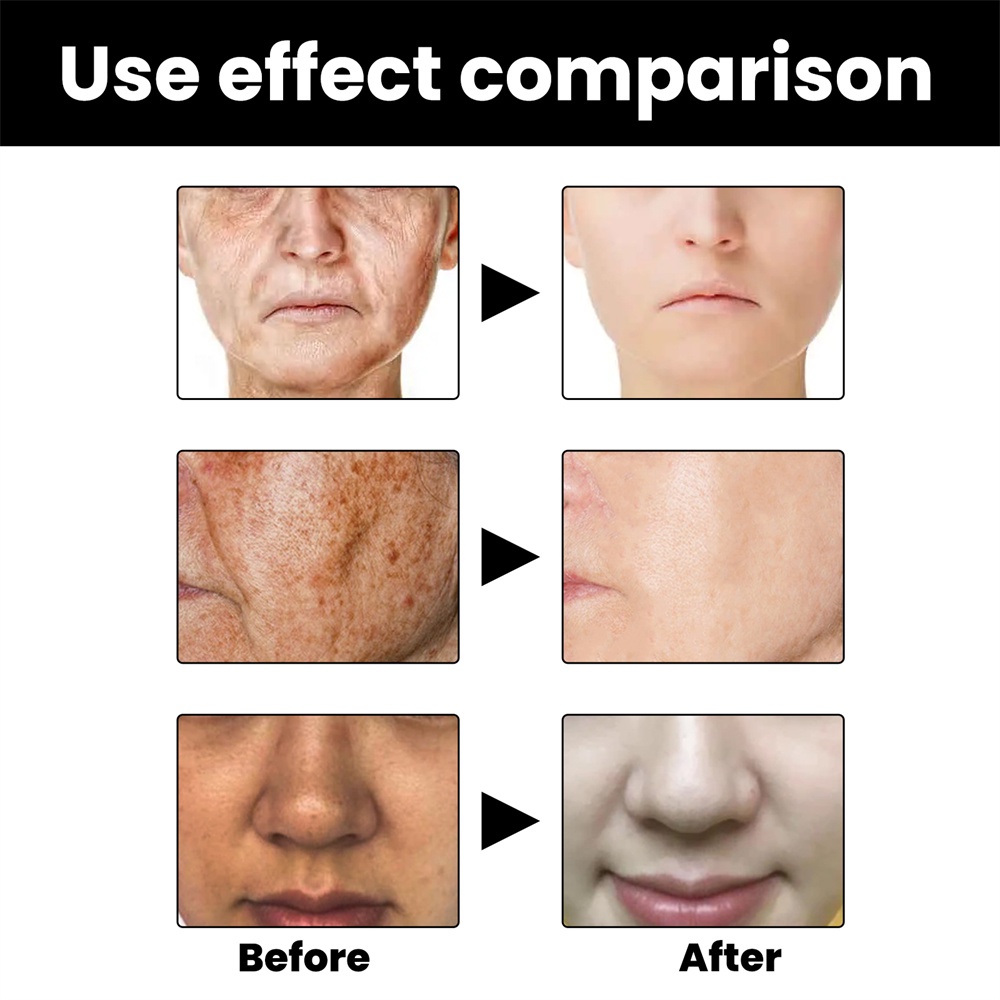 Serum điều chỉnh sắc tố da mặt JULYSTAR giảm vết thâm hàng ngày